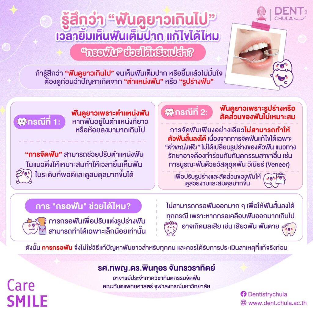 รู้สึกว่าฟันยาวยิ้มไม่สวย แก้ยังไง คณะทันตแพทยศาสตร์ จุฬาลงกรณ์มหาวิทยาลัย