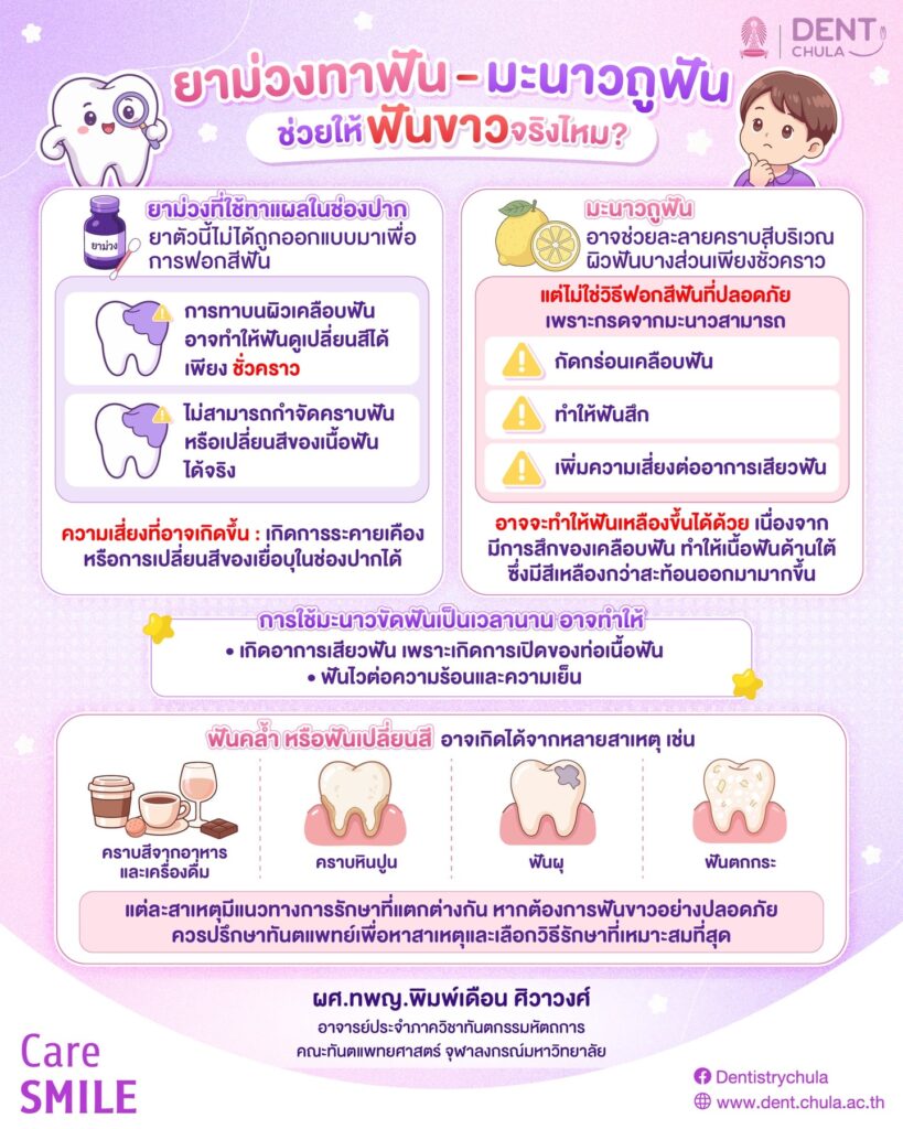 อยากฟันขาวเร่งด่วน คณะทันตแพทยศาสตร์ จุฬาลงกรณ์มหาวิทยาลัย