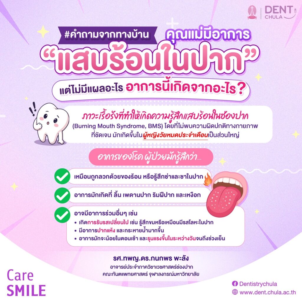 อาการแสบร้อนในปาก 1 0 คณะทันตแพทยศาสตร์ จุฬาลงกรณ์มหาวิทยาลัย
