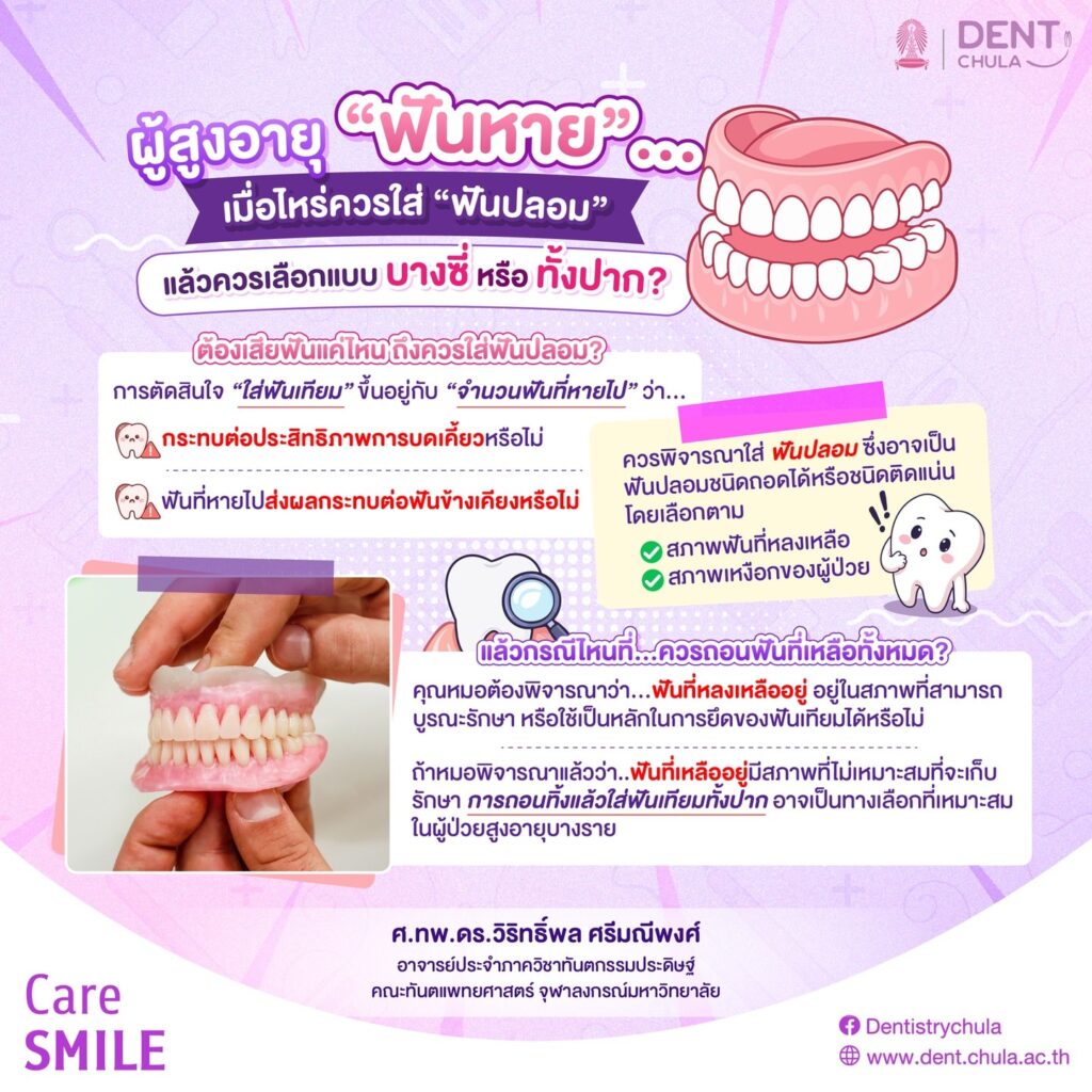 เลือกใส่ฟันปลอมหรือถอนฟันทิ้ง คณะทันตแพทยศาสตร์ จุฬาลงกรณ์มหาวิทยาลัย