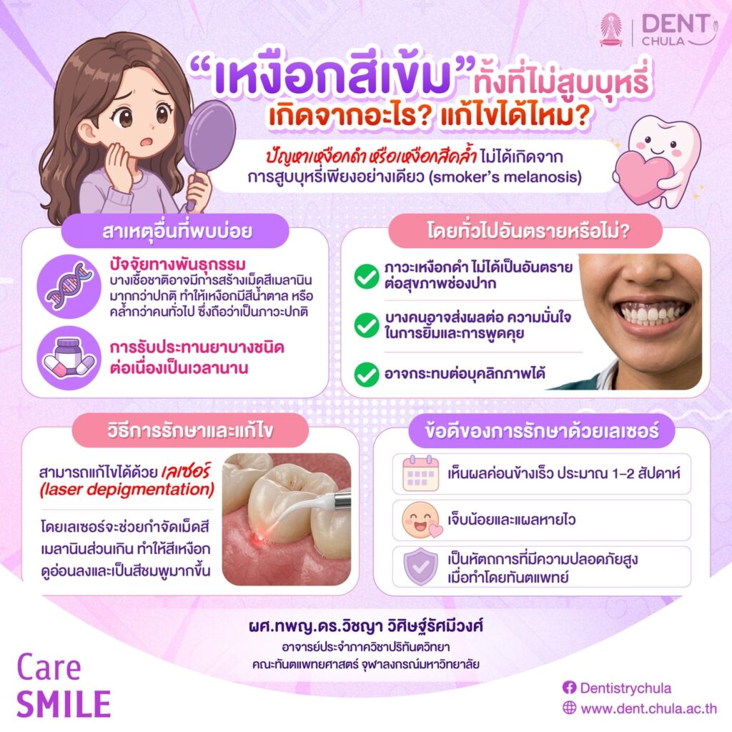 เหงือกดำ ทั้งที่ไม่ได้สูบบุหรี่ คณะทันตแพทยศาสตร์ จุฬาลงกรณ์มหาวิทยาลัย
