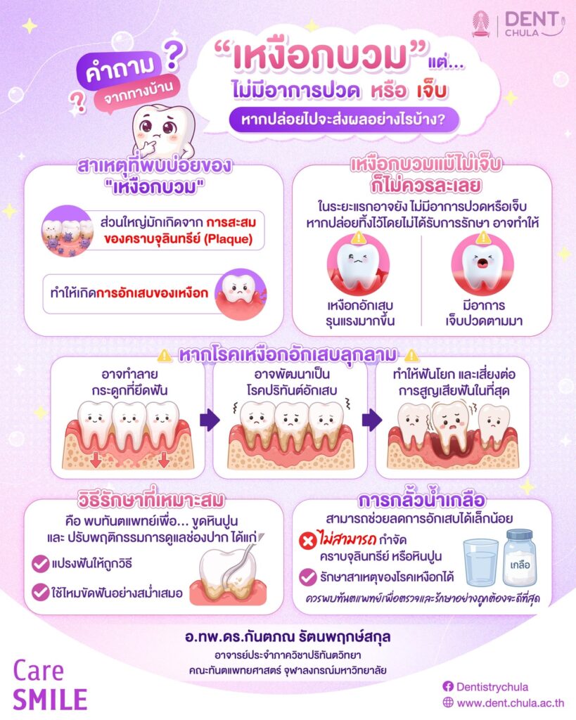 เหงือกบวมแต่ไม่ปวด ต้องกังวลไหม คณะทันตแพทยศาสตร์ จุฬาลงกรณ์มหาวิทยาลัย