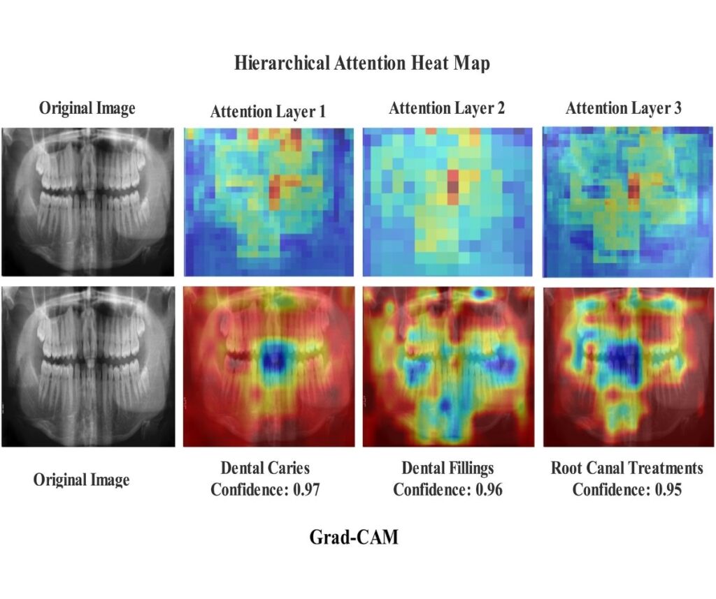 A Dual Stream Deep Learning Framework for Multi Label Classification of Dental Conditions in Panoramic Radiographs With Explainable AI Integration Faculty of Dentistry, Chulalongkorn University
