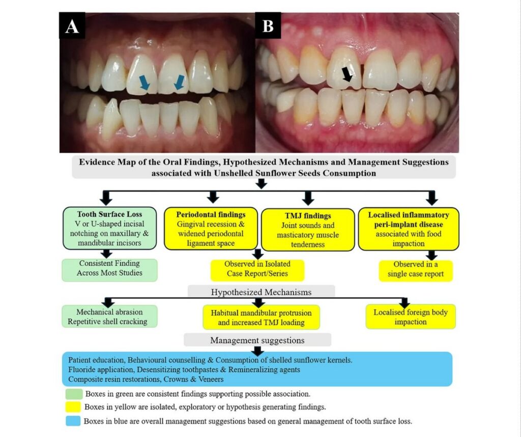 10.3389froh.2026.1889799 Fig e1793080096880 Faculty of Dentistry, Chulalongkorn University